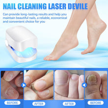 Rechargeable Nail Fungus Laser â€“ Anti-Fungal Device Toenails, Hands & Feet (Home Use)